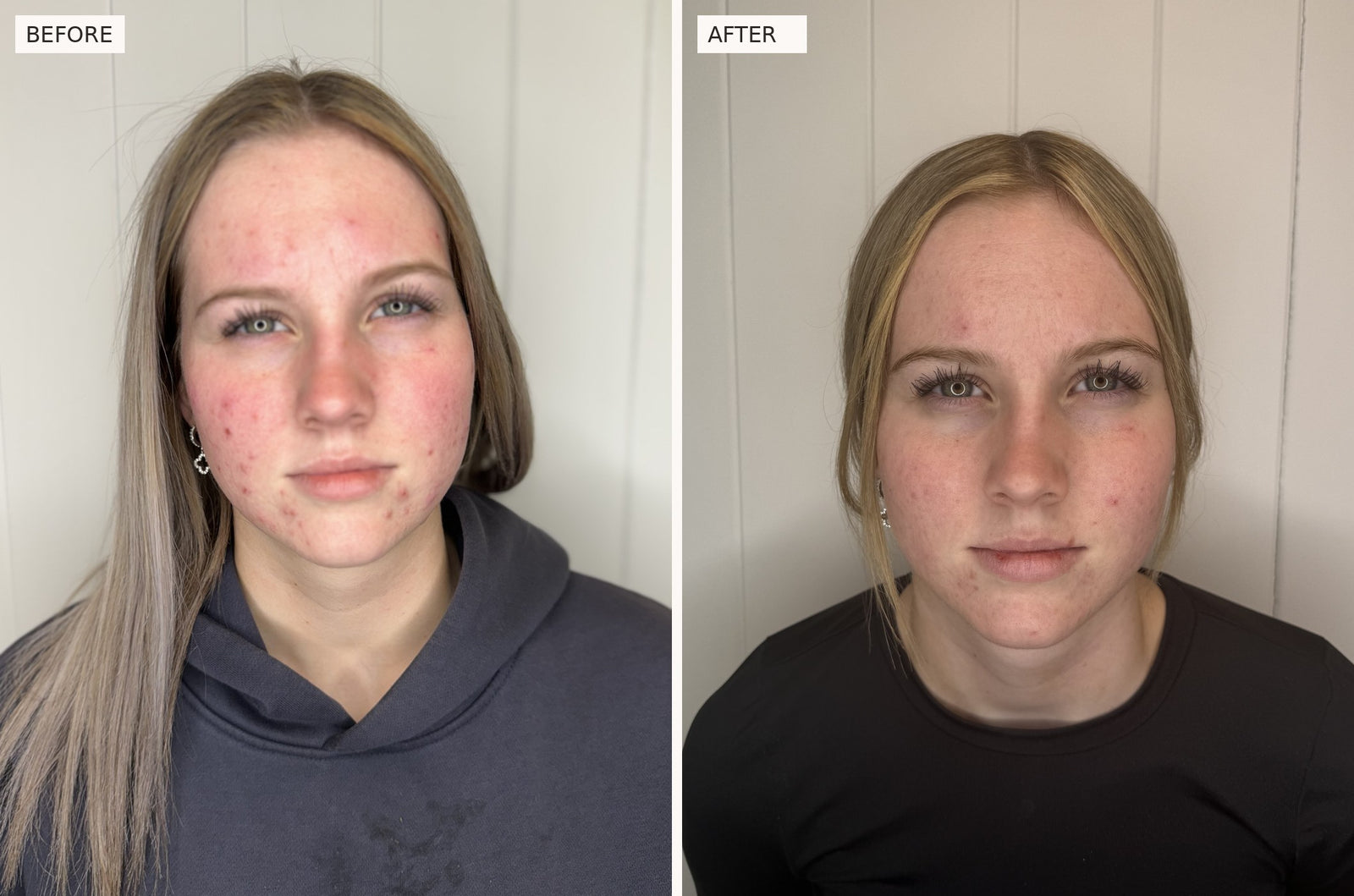 Clear Skin Protocol, front